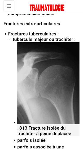 Traumatology Screenshot8
