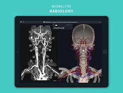 Complete Anatomy 2024 Screenshot15